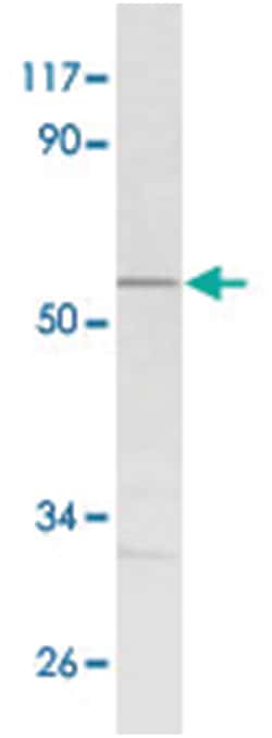 AKT1 (phospho T308), Rabbit anti-Human, Polyclonal Antibody, Abnova 100 &mu;L | Buy Online | Abnova Corporation | Fisher Scientific