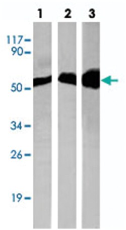 TUBB 1/2/3/5/6/8, Rabbit, Polyclonal Antibody, Abnova 100&mu;L; Unlabeled:Antibodies,