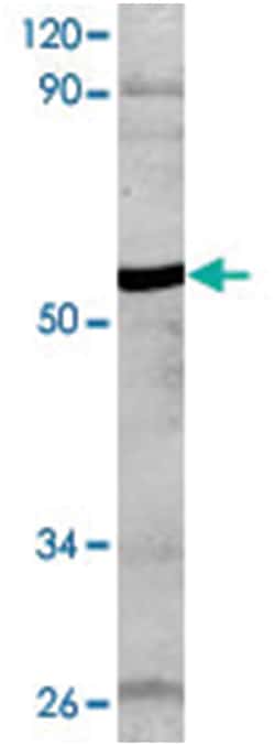 GFAP (phospho S38), Rabbit anti-Human, Polyclonal Antibody, Abnova 100&mu;L;