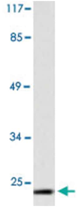 CGB Rabbit anti-Human, Polyclonal Antibody, Abnova 100 &mu;L | Buy Online | Abnova Corporation | Fisher Scientific