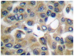 CGB Rabbit anti-Human, Polyclonal Antibody, Abnova 100 &mu;L | Buy Online | Abnova Corporation | Fisher Scientific