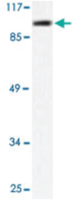 HDAC9 Rabbit anti-Human, Polyclonal Antibody, Abnova 100 &mu;L | Buy Online | Abnova Corporation | Fisher Scientific