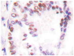 HDAC9 Rabbit anti-Human, Polyclonal Antibody, Abnova 100 &mu;L | Buy Online | Abnova Corporation | Fisher Scientific