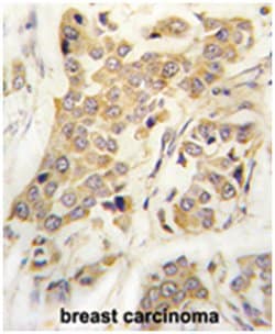 CDH8, Rabbit, Polyclonal Antibody, Abnova 400&mu;L; Unlabeled:Antibodies,