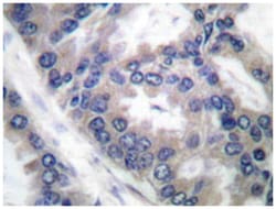 NOS2 Rabbit anti-Human, Polyclonal Antibody, Abnova 100&mu;L; Unlabeled:Antibodies,