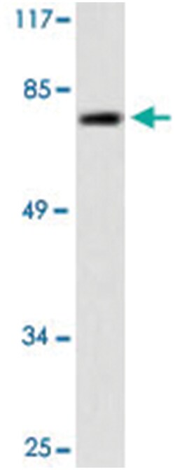 IVL Rabbit anti-Human, Polyclonal Antibody, Abnova 100&mu;L; Unlabeled:Antibodies,