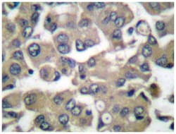 IVL Rabbit anti-Human, Polyclonal Antibody, Abnova 100&mu;L; Unlabeled:Antibodies,