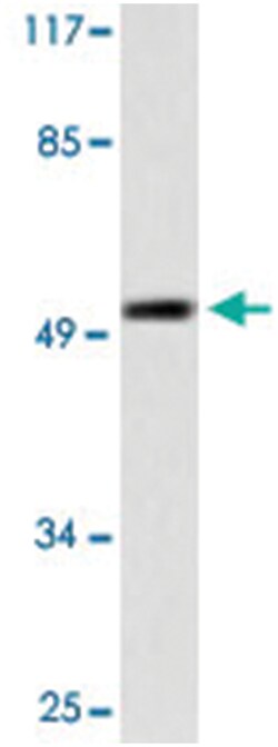 KRT7 Rabbit anti-Human, Polyclonal Antibody, Abnova 100&mu;L; Unlabeled:Antibodies,