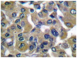 KRT7 Rabbit anti-Human, Polyclonal Antibody, Abnova 100&mu;L; Unlabeled:Antibodies,
