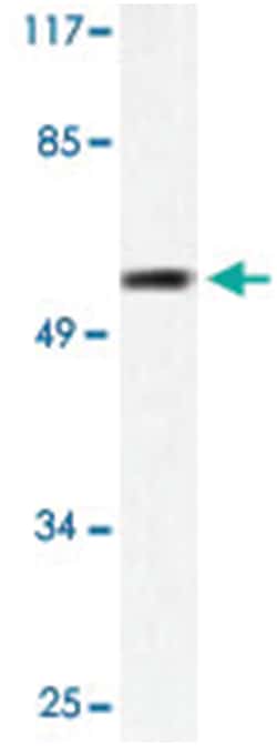 MMP1 Rabbit anti-Human, Polyclonal Antibody, Abnova 100 &mu;L | Buy Online | Abnova Corporation | Fisher Scientific