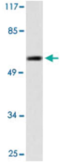 MMP13 Rabbit anti-Human, Polyclonal Antibody, Abnova 100&mu;L; Unlabeled:Antibodies,