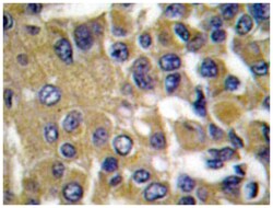 MMP13 Rabbit anti-Human, Polyclonal Antibody, Abnova 100&mu;L; Unlabeled:Antibodies,