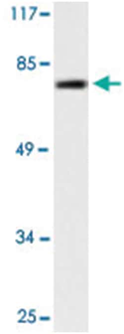 MMP9 Rabbit anti-Human, Polyclonal Antibody, Abnova 100 &mu;L | Buy Online | Abnova | Fisher Scientific