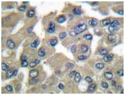 MMP9 Rabbit anti-Human, Polyclonal Antibody, Abnova 100 &mu;L | Buy Online | Abnova | Fisher Scientific