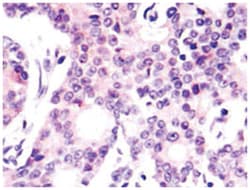NFKB1 Rabbit anti-Human, Polyclonal Antibody, Abnova 100 &mu;L | Buy Online | Abnova Corporation | Fisher Scientific