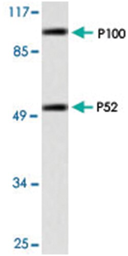NFKB1 Rabbit anti-Human, Polyclonal Antibody, Abnova 100 &mu;L | Buy Online | Abnova Corporation | Fisher Scientific