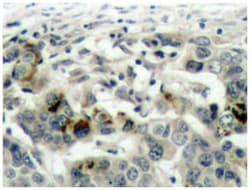 NFKB1 Rabbit anti-Human, Polyclonal Antibody, Abnova 100 &mu;L | Buy Online | Abnova Corporation | Fisher Scientific