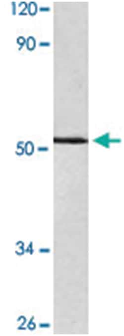 TP53 Rabbit anti-Human, Polyclonal Antibody, Abnova 100 &mu;L | Buy Online | Abnova Corporation | Fisher Scientific