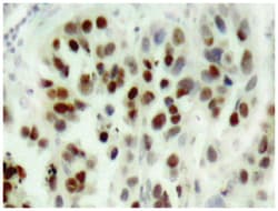 TP53 Rabbit anti-Human, Polyclonal Antibody, Abnova 100 &mu;L | Buy Online | Abnova Corporation | Fisher Scientific