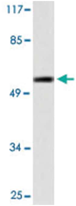 TP53 Rabbit anti-Human, Polyclonal Antibody, Abnova 100 &mu;L | Buy Online | Abnova Corporation | Fisher Scientific