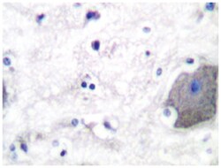 PSEN1 Rabbit anti-Human, Polyclonal Antibody, Abnova 100 &mu;L | Buy Online | Abnova Corporation | Fisher Scientific
