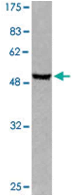 GFAP Rabbit anti-Human, Polyclonal Antibody, Abnova 100 &mu;L | Buy Online | Abnova Corporation | Fisher Scientific