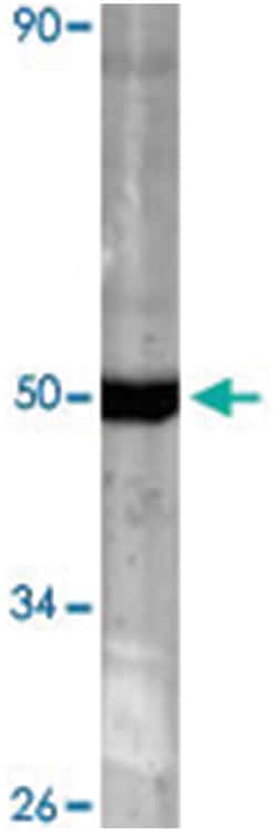 MAP2K1 Rabbit anti-Human, Polyclonal Antibody, Abnova 100 &mu;L | Buy Online | Abnova Corporation | Fisher Scientific