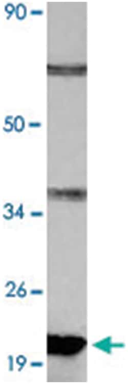 ABCC11, Rabbit, Polyclonal Antibody, Abnova 100&mu;L; Unlabeled:Antibodies,