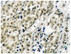AR Rabbit anti-Human, Polyclonal Antibody, Abnova 100 &mu;L | Buy Online | Abnova Corporation | Fisher Scientific