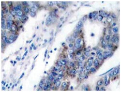 MAP3K5 Rabbit anti-Human, Polyclonal Antibody, Abnova 100 &mu;L | Buy Online | Abnova Corporation | Fisher Scientific
