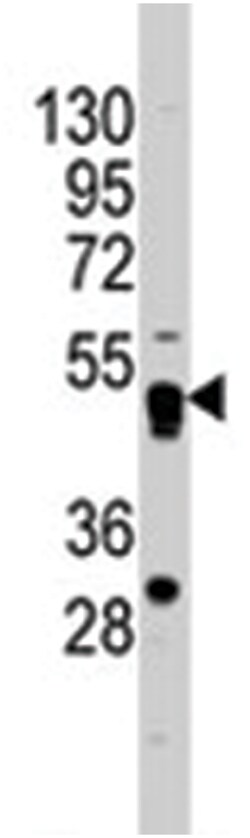GATA4, Rabbit, Polyclonal Antibody, Abnova 400 &mu;L | Buy Online | Abnova Corporation | Fisher Scientific
