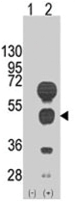GATA4, Rabbit, Polyclonal Antibody, Abnova 400 &mu;L | Buy Online | Abnova Corporation | Fisher Scientific