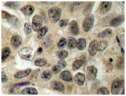 CDC25C Rabbit anti-Human, Polyclonal Antibody, Abnova 100&mu;L; Unlabeled:Antibodies,