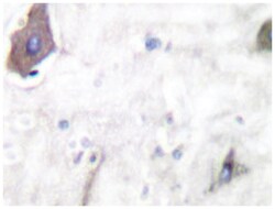 COX1 Rabbit anti-Human, Polyclonal Antibody, Abnova 100&mu;L; Unlabeled:Antibodies,