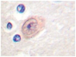 CSE1L Rabbit anti-Human, Polyclonal Antibody, Abnova 100 &mu;L | Buy Online | Abnova Corporation | Fisher Scientific