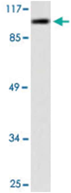 CDH1 Rabbit anti-Human, Polyclonal Antibody, Abnova 100 &mu;L | Buy Online | Abnova Corporation | Fisher Scientific