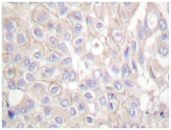 CDH1 Rabbit anti-Human, Polyclonal Antibody, Abnova 100 &mu;L | Buy Online | Abnova Corporation | Fisher Scientific