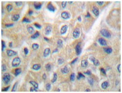 FHIT Rabbit anti-Human, Polyclonal Antibody, Abnova 100 &mu;L | Buy Online | Abnova Corporation | Fisher Scientific