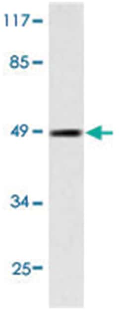 MAPT Rabbit anti-Human, Polyclonal Antibody, Abnova 100 &mu;L | Buy Online | Abnova Corporation | Fisher Scientific