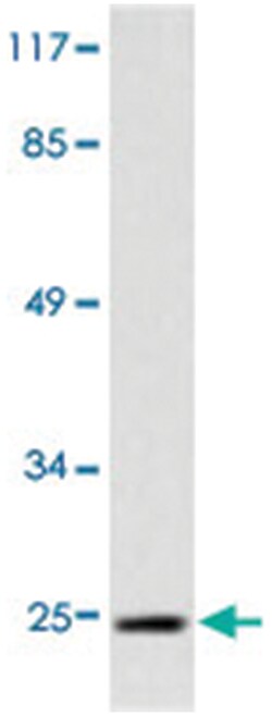 IAPP Rabbit anti-Human, Polyclonal Antibody, Abnova 100 &mu;L | Buy Online | Abnova Corporation | Fisher Scientific