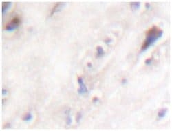 IAPP Rabbit anti-Human, Polyclonal Antibody, Abnova 100 &mu;L | Buy Online | Abnova Corporation | Fisher Scientific