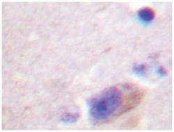 PARK2 Rabbit anti-Human, Polyclonal Antibody, Abnova 100 &mu;L | Buy Online | Abnova Corporation | Fisher Scientific