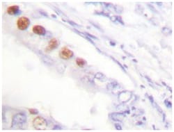 MKI67 Rabbit anti-Human, Polyclonal Antibody, Abnova 100 &mu;L | Buy Online | Abnova Corporation | Fisher Scientific