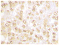 NKX3-1 Rabbit anti-Human, Polyclonal Antibody, Abnova 100 &mu;L | Buy Online | Abnova | Fisher Scientific