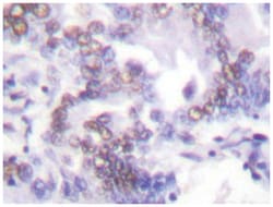 SENP6 Rabbit anti-Human, Polyclonal Antibody, Abnova 100 &mu;L | Buy Online | Abnova Corporation | Fisher Scientific