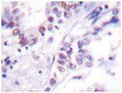 UBA2 Rabbit anti-Human, Polyclonal Antibody, Abnova 100&mu;L; Unlabeled:Antibodies,