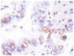 XRCC3 Rabbit anti-Human, Polyclonal Antibody, Abnova 100&mu;L; Unlabeled:Antibodies,