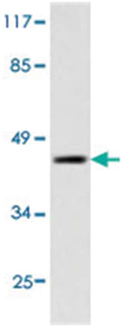 XRCC4, Rabbit, Polyclonal Antibody, Abnova 100&mu;L; Unlabeled:Antibodies,