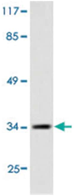 CEBPE Rabbit anti-Human, Polyclonal Antibody, Abnova 100 &mu;L | Buy Online | Abnova Corporation | Fisher Scientific