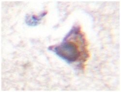 CEBPE Rabbit anti-Human, Polyclonal Antibody, Abnova 100 &mu;L | Buy Online | Abnova Corporation | Fisher Scientific